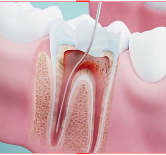 https://carkdispoliklinigi.com/wp-content/uploads/2023/10/ENDODONTI-640x600.png