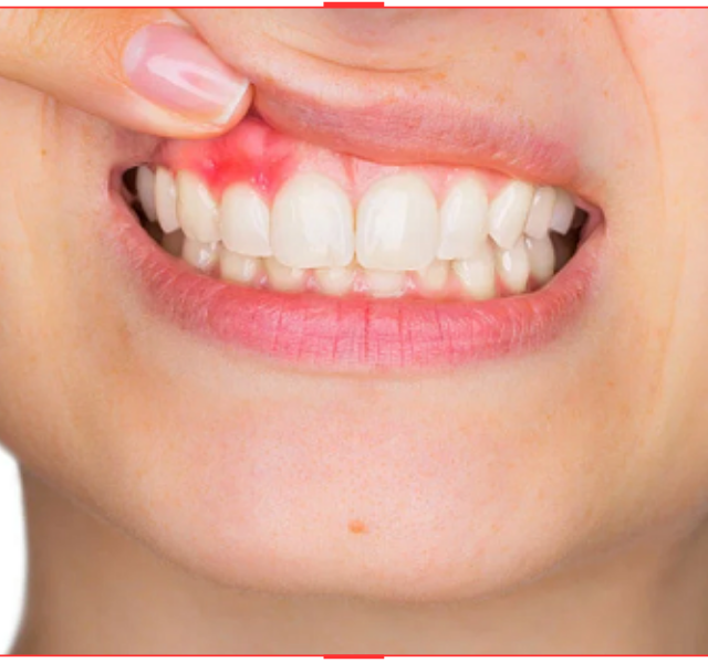 https://carkdispoliklinigi.com/wp-content/uploads/2023/10/PERIODONTOLOJI-640x600.png